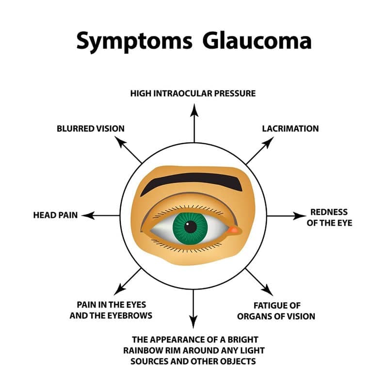 Rajah Gejala Glaukoma